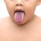 Oral Thrush in Babies