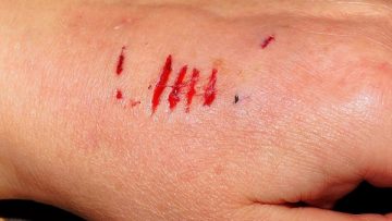 cut