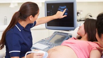 c3b6d24d0928037e-3bafa7ce58ef-ultrasound