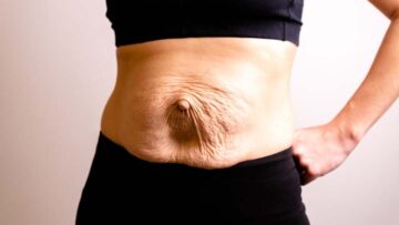 Postpartum