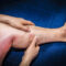 deep-vein-thrombosis