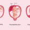 Placenta