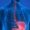 esophageal-conditions